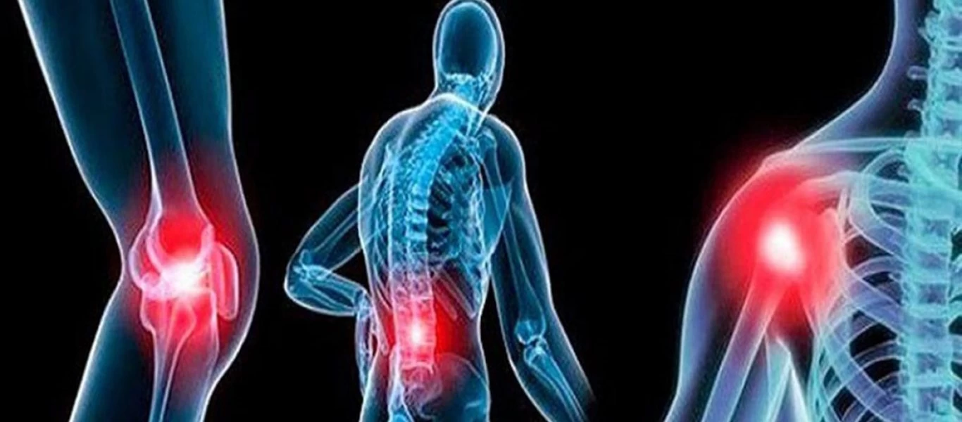 Πολλαπλή Σκλήρυνση: Τι ρόλο παίζει το κλίμα στα πρώιμα συμπτώματα;